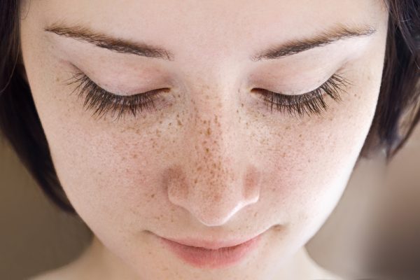 best-methods-for-freckles-treatment